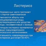 ИСПАНИЯ: ЦЕНА ЗА СВЕТ РАСТЕТ НА 100 ЕВРО В СУТКИ ЗА МЕГАВАТТ-ЧАС